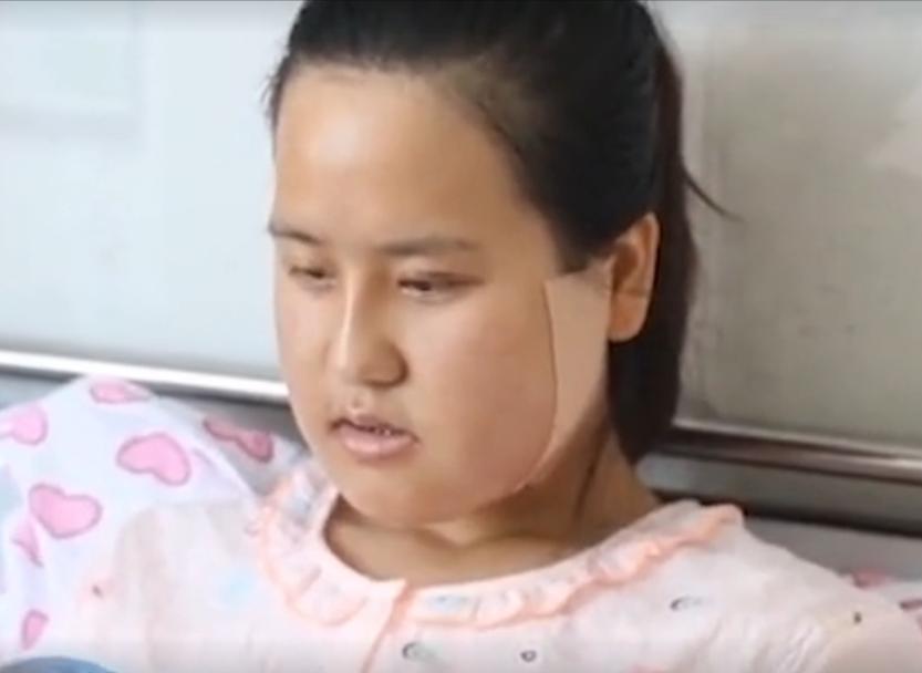 东北“歪脸”女孩整形成大美女，拒绝当网红，只想回山村当教师