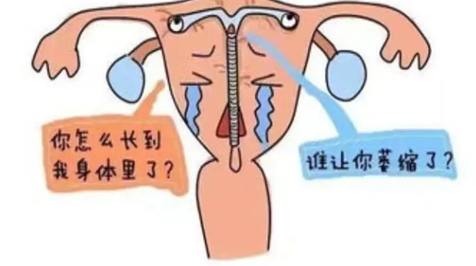中国第一批“上环”的女性，医生坦白：30年了，恐难逃这3种结局