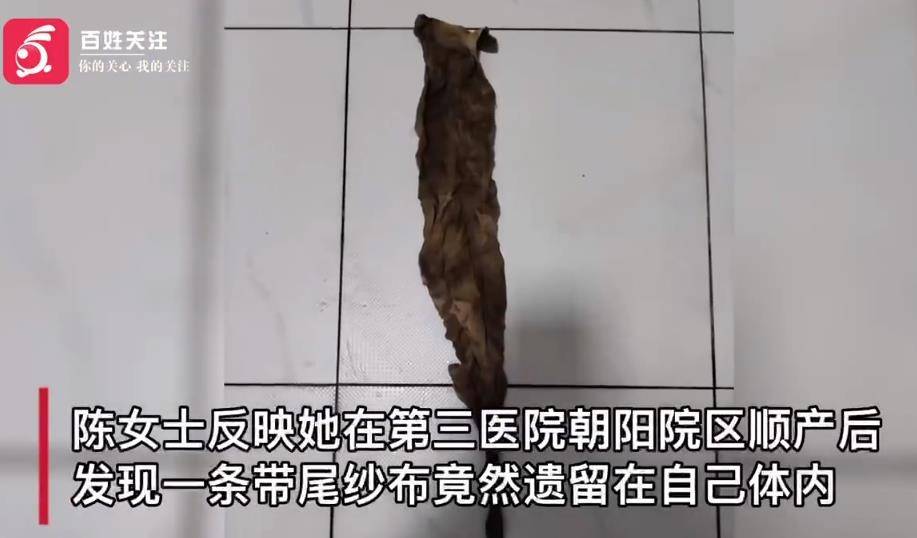 医院回应女子生产后纱布遗留体,女子顺产体内为什么留纱布