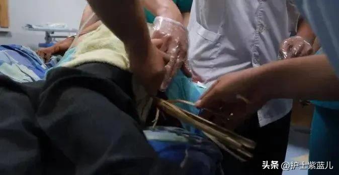 老人不慎从楼梯上重重摔下,老人意外从楼上摔下来