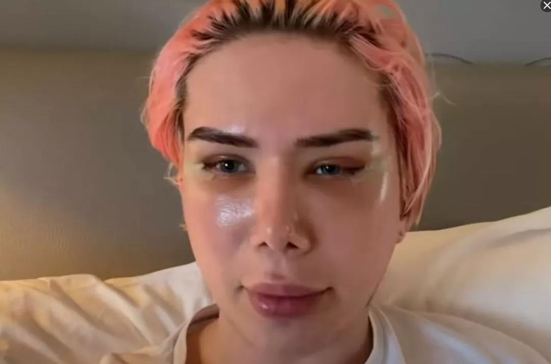 白人网红沉迷韩国流行文化，疯狂整容还做丁丁缩小术？