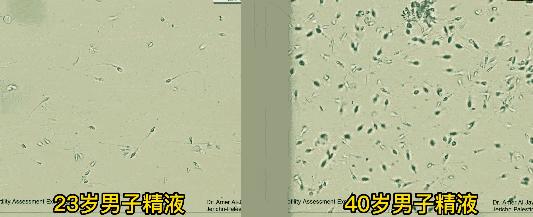 云南和陕西先后发布捐精倡议书捐精其实没你想的那么简单