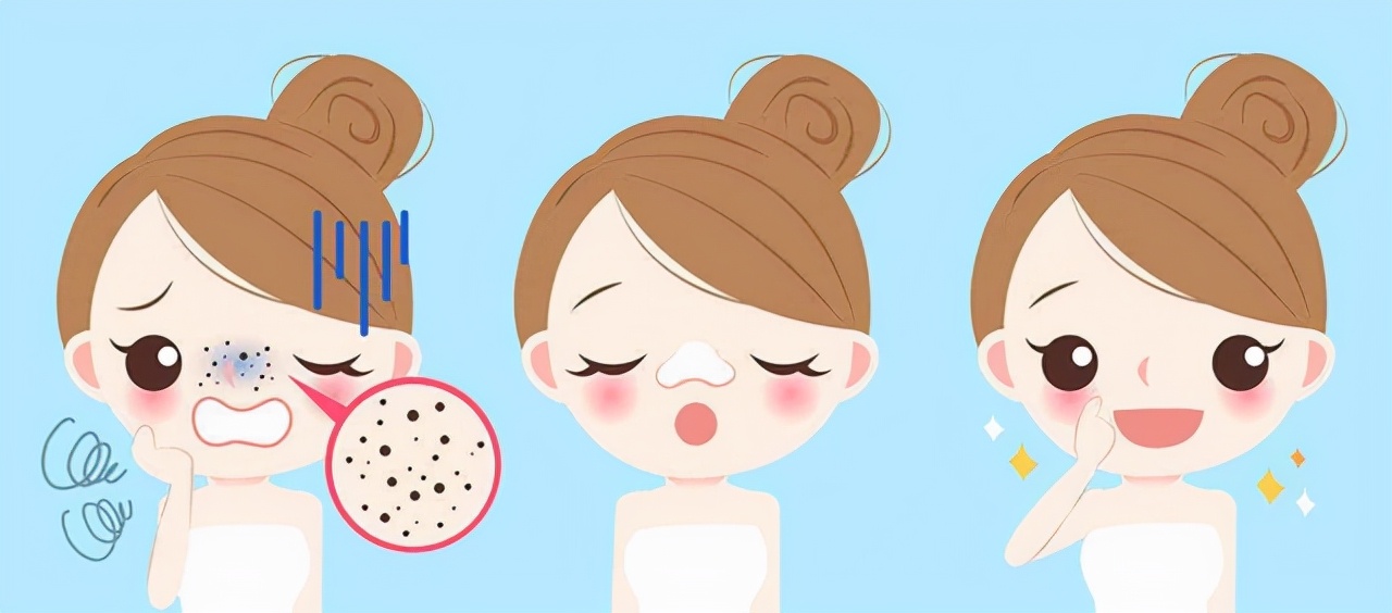 去黑头最佳有效的方法,如何简单有效的去黑头