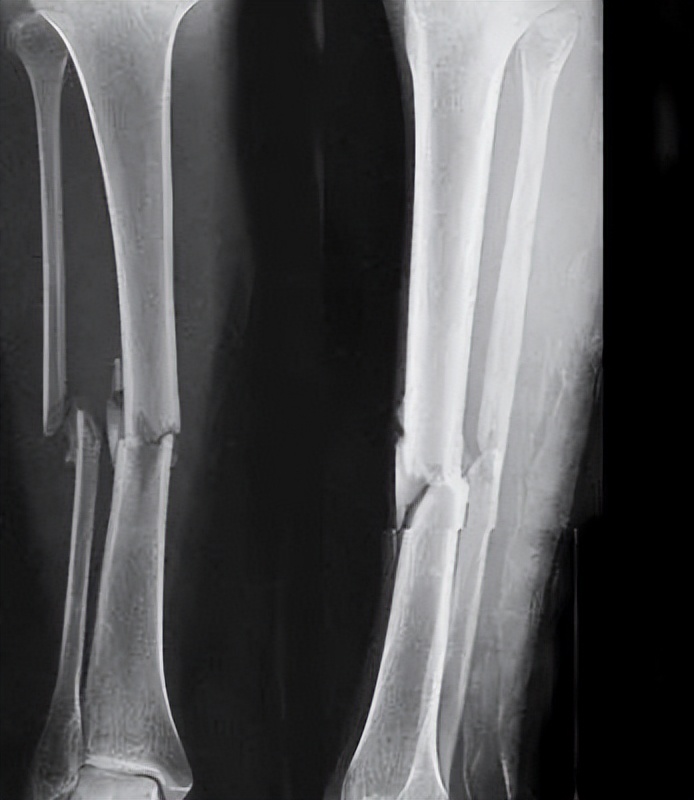 太原95后征兵体检,山西征兵下半年体检什么时候开始