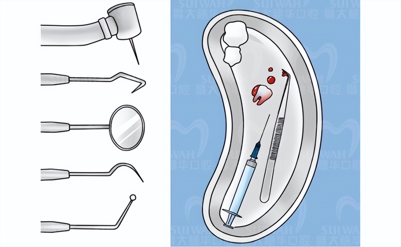 拔了智齿有个洞有食物残留怎么办,拔了智齿留了洞里面还出血正常吗
