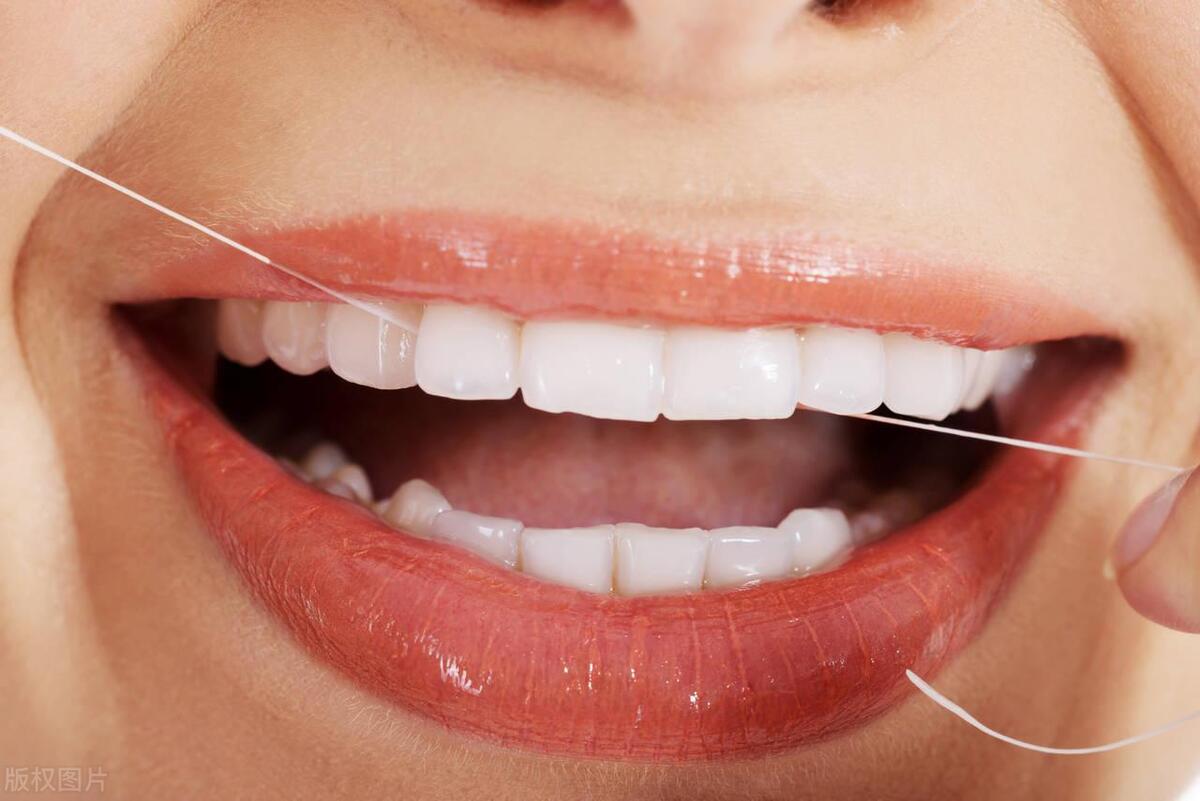 去除牙菌斑最有效的方法,牙菌斑要怎么去除最简单的方法