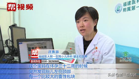 婴儿出生囊肿,宝宝出生颈部淋巴囊肿