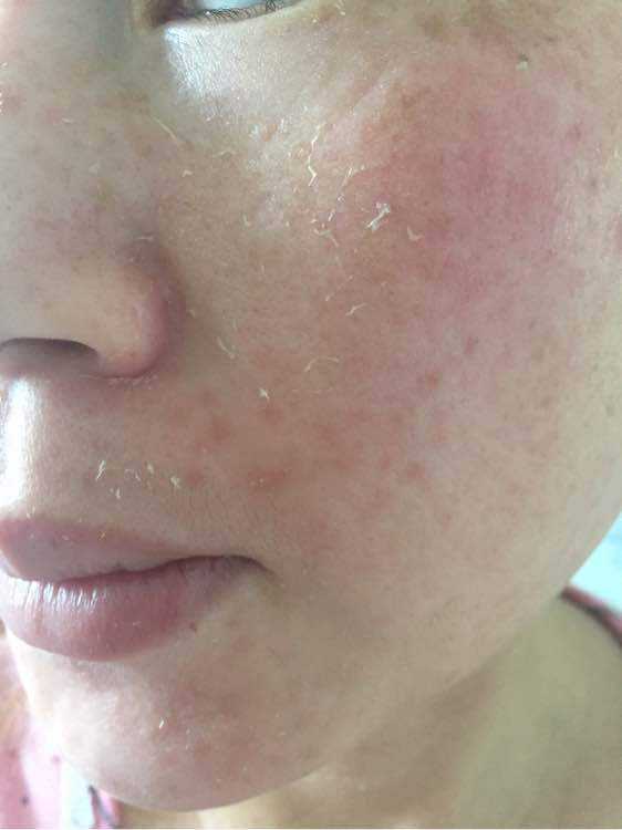 怎么样才能让脸变得白白净净,怎么让自己的脏脸变得很干净