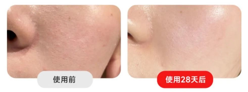 全网爆款美容仪,红光灯美容仪推荐