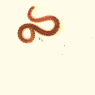 科学家发现了可怕的寄生虫,科学家发现寄生虫