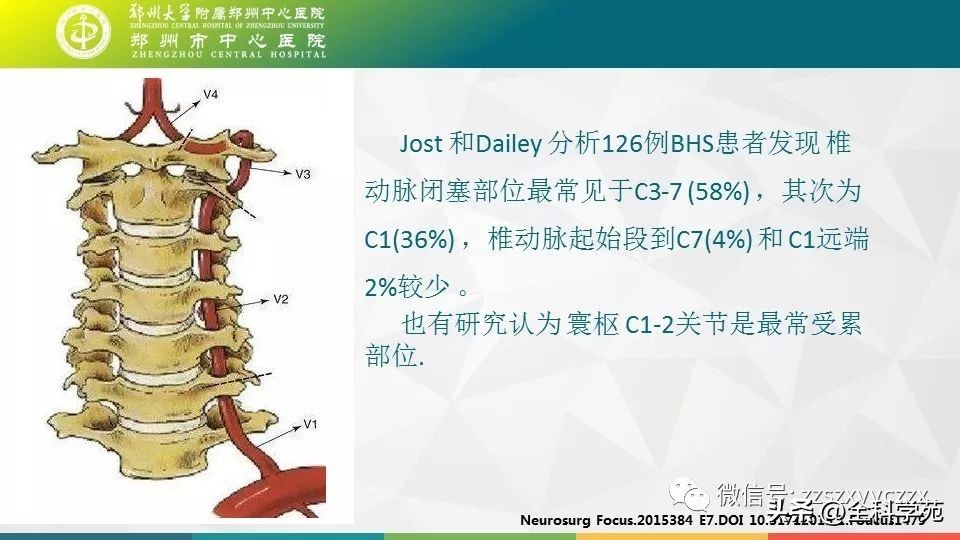 条件反射性眩晕,一种莫名的眩晕