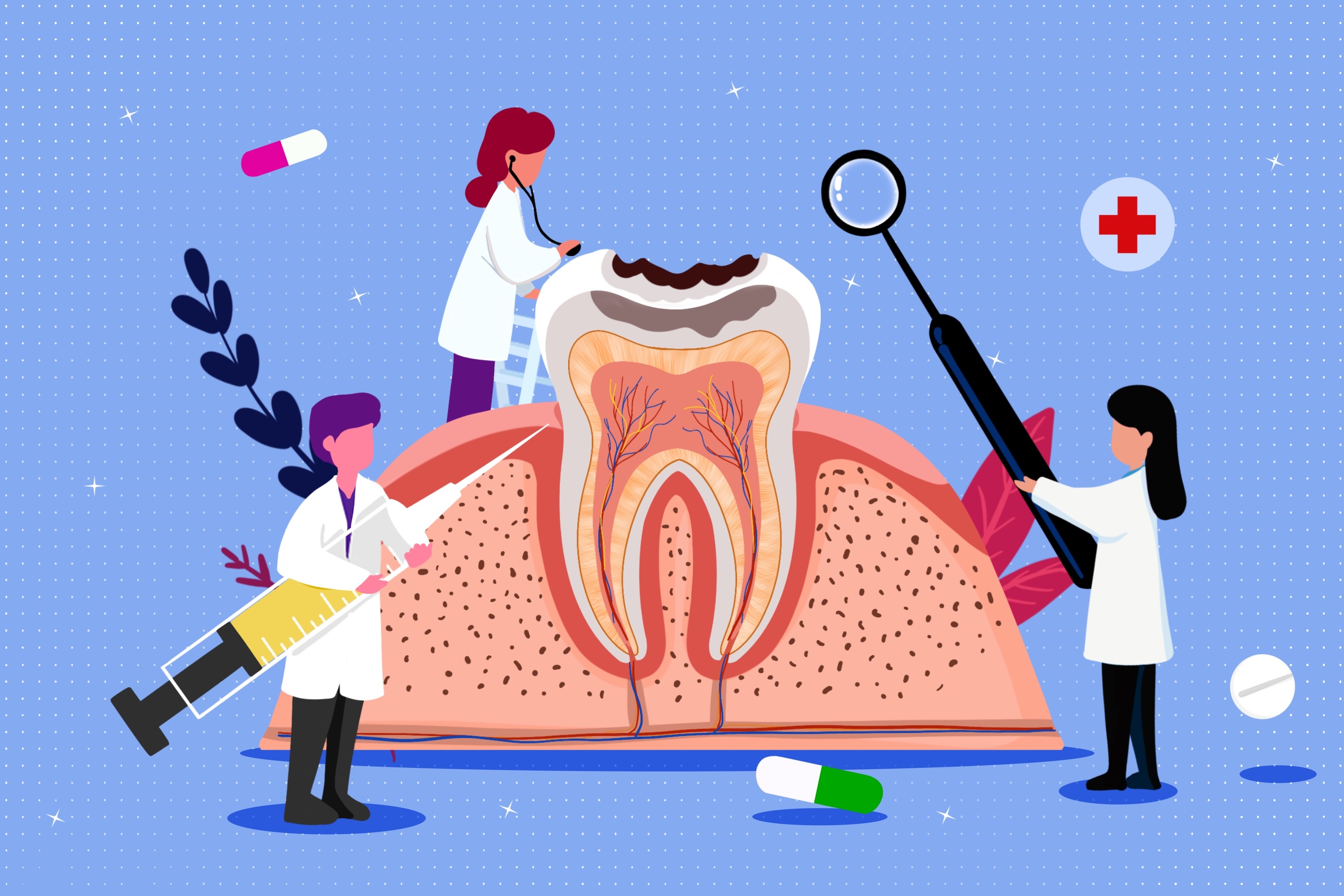 根管治疗洞大好还是小好,根管治疗和修补