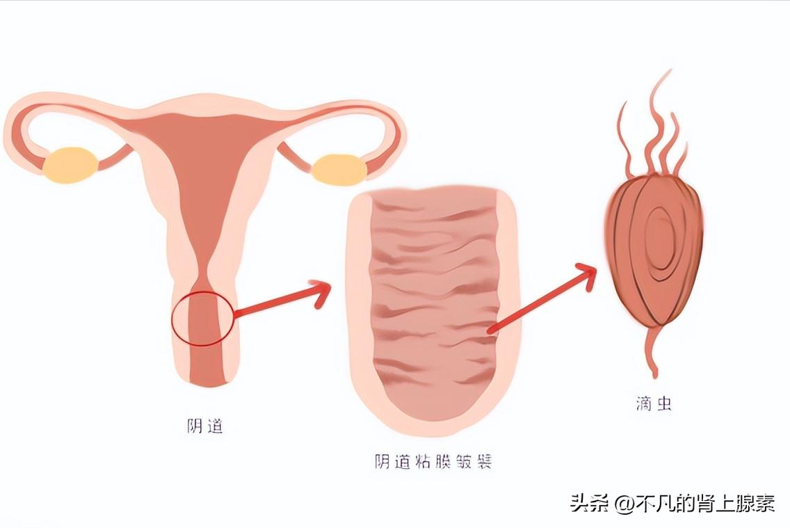 这些妇科病不用治,这些妇科问题别忽视
