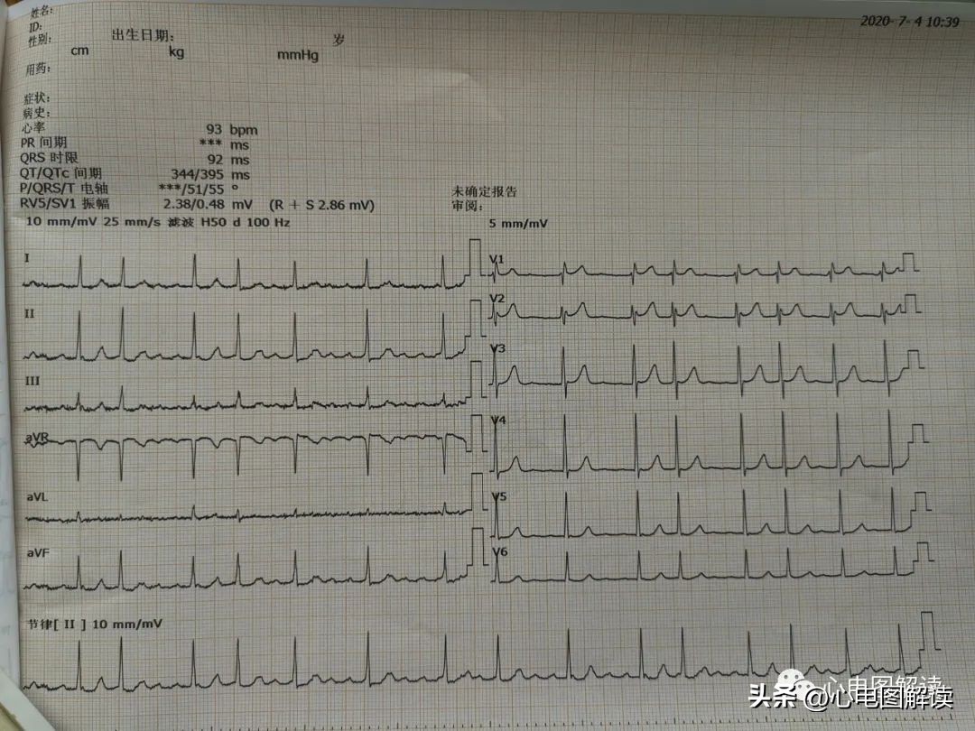 得来不易歌曲视频,得来不易纯音乐