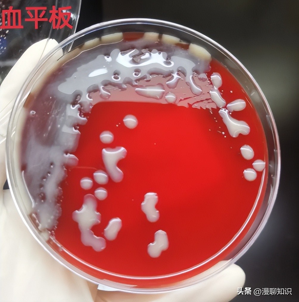 老年人得了肺炎应如何有效医治,肺炎有多严重怎么办