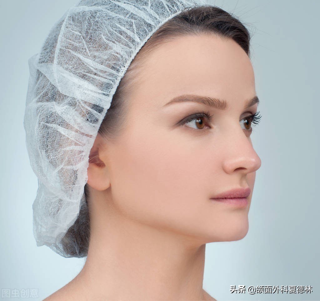 磨骨后脸垮的样子,磨骨后脸下垂特别厉害