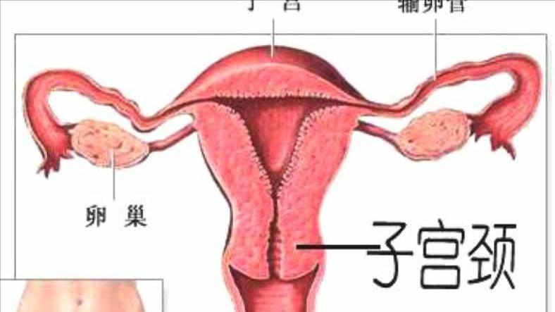 宫颈糜烂：一种坑了无数女性的“妇科病”！它的发生与什么有关？