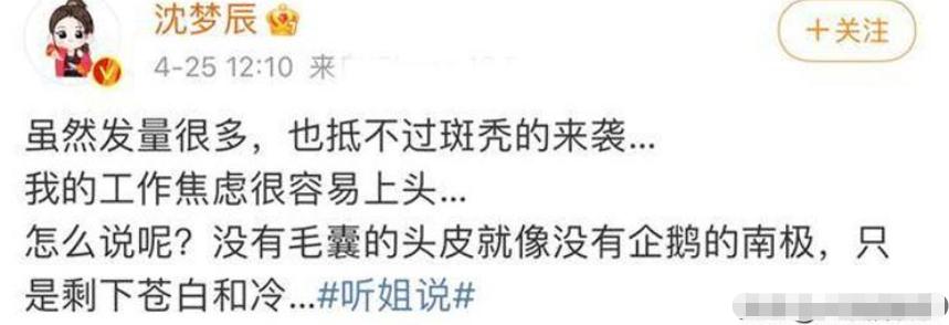 明星逃不过的脱发,明星也秃头还戴假发片