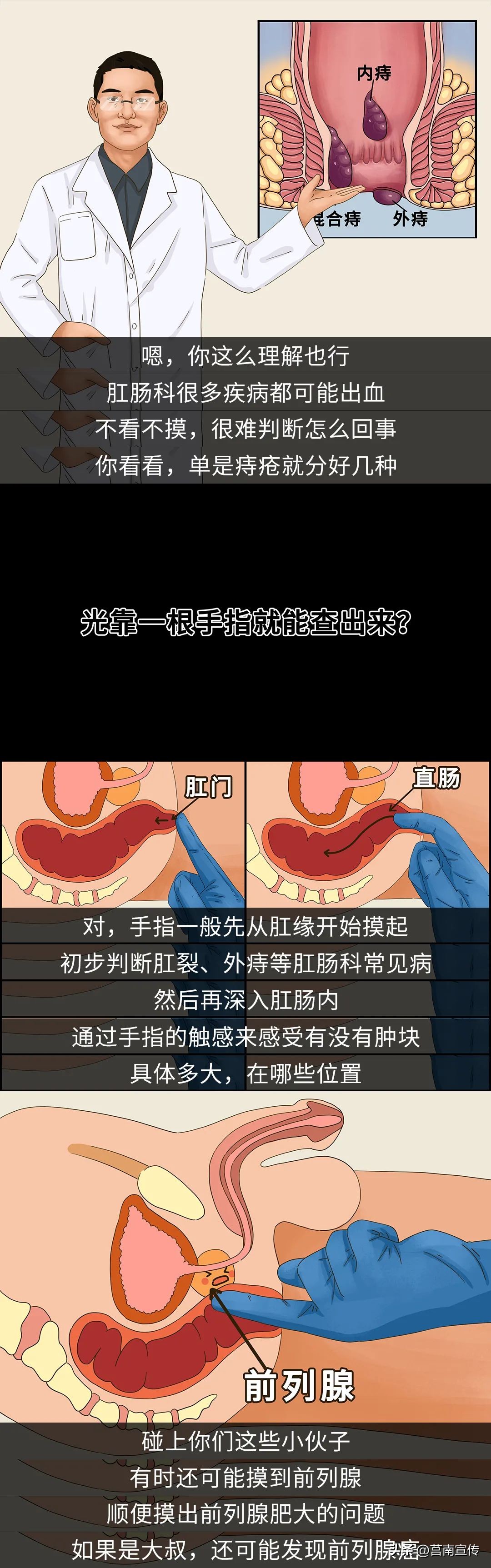 用一根手指捅入肛门，是个正经且重要的检查