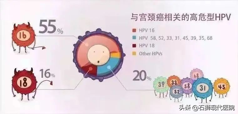 48岁的女人妇科体检应该做哪几项,妇科检查怎么查