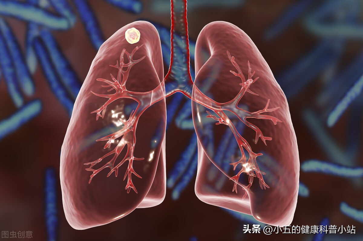 孟鲁司特钠片对过敏性哮喘有效吗,孟鲁司特钠片治鼻炎引起的哮喘吗