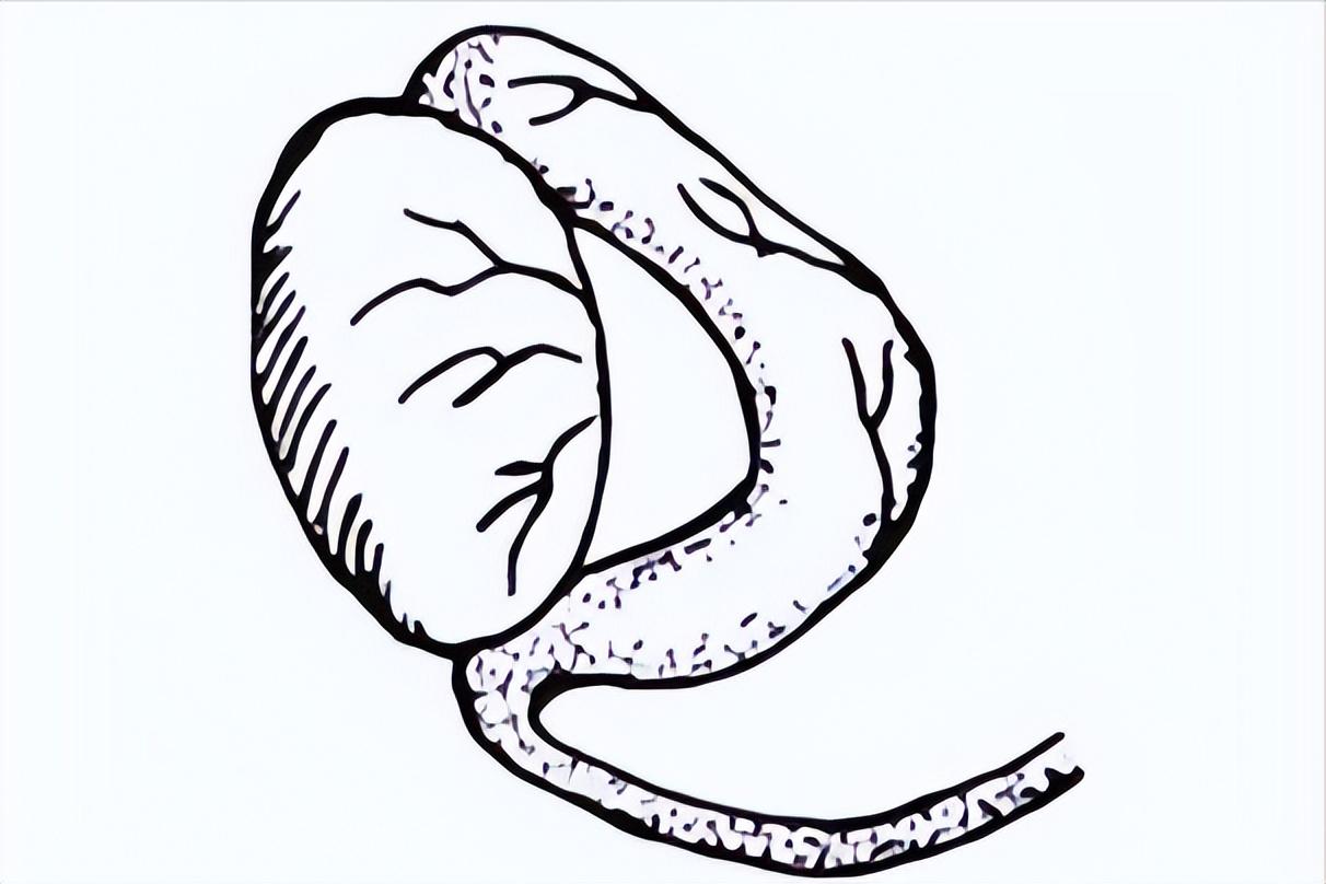 精子常见的问题,精子的常见问题