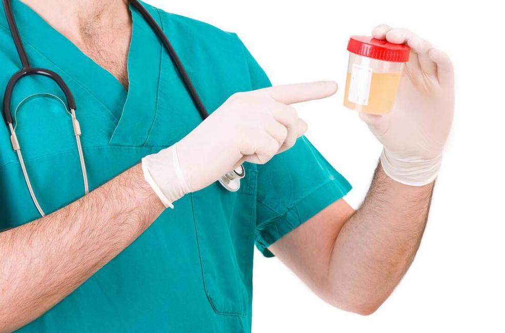 这些食物升糖快最好管住嘴,100种常见食物升糖指数快收藏