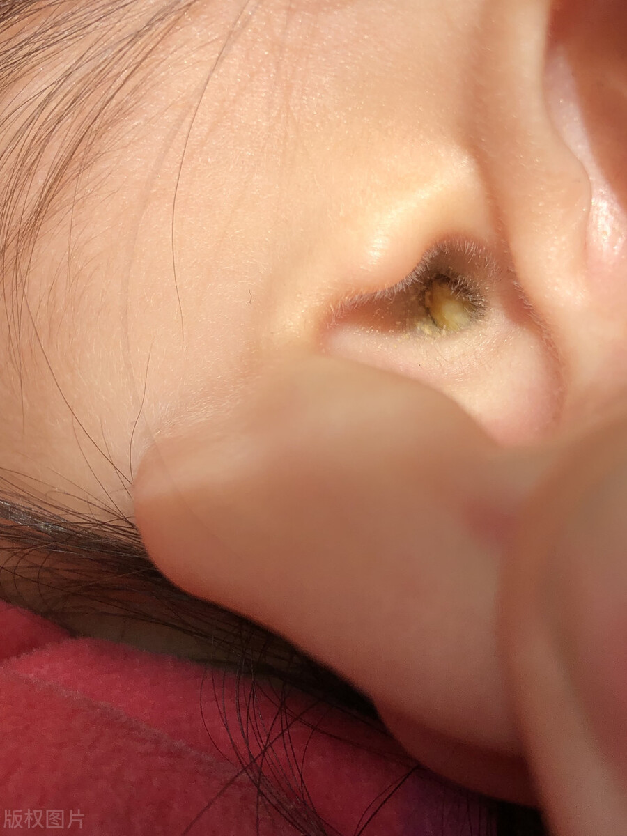 两只耳朵听力不一样且听到声音晕,两只耳朵听力不一样怎么配助听器