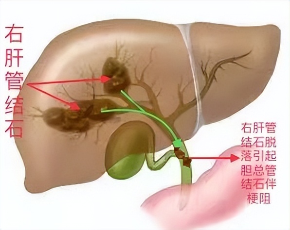 医患故事七面锦旗述说生命奇迹,医院锦旗故事