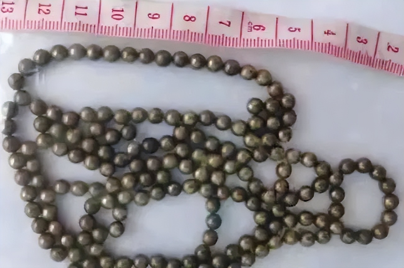 6岁女孩阴道被烧焦、13岁男孩体内惊现“蛇形异物”