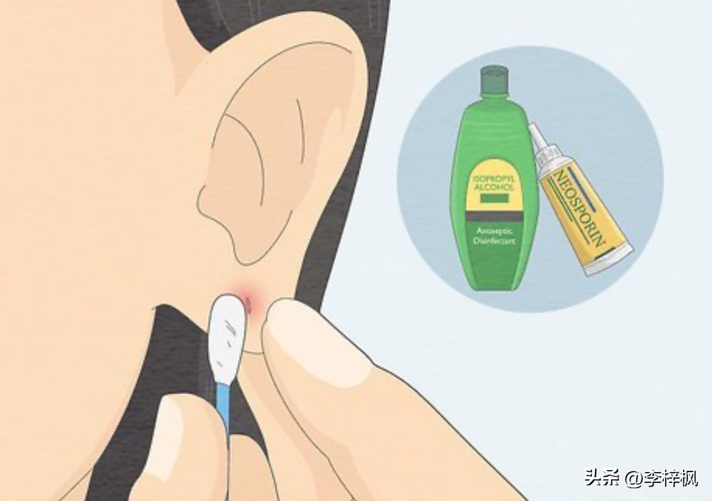 耳洞臭臭的怎么整啊,耳洞臭臭的是什么原因