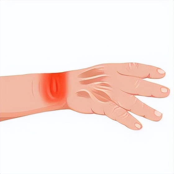 艾滋早期症状会咳痰么,男士艾滋的10个早期症状