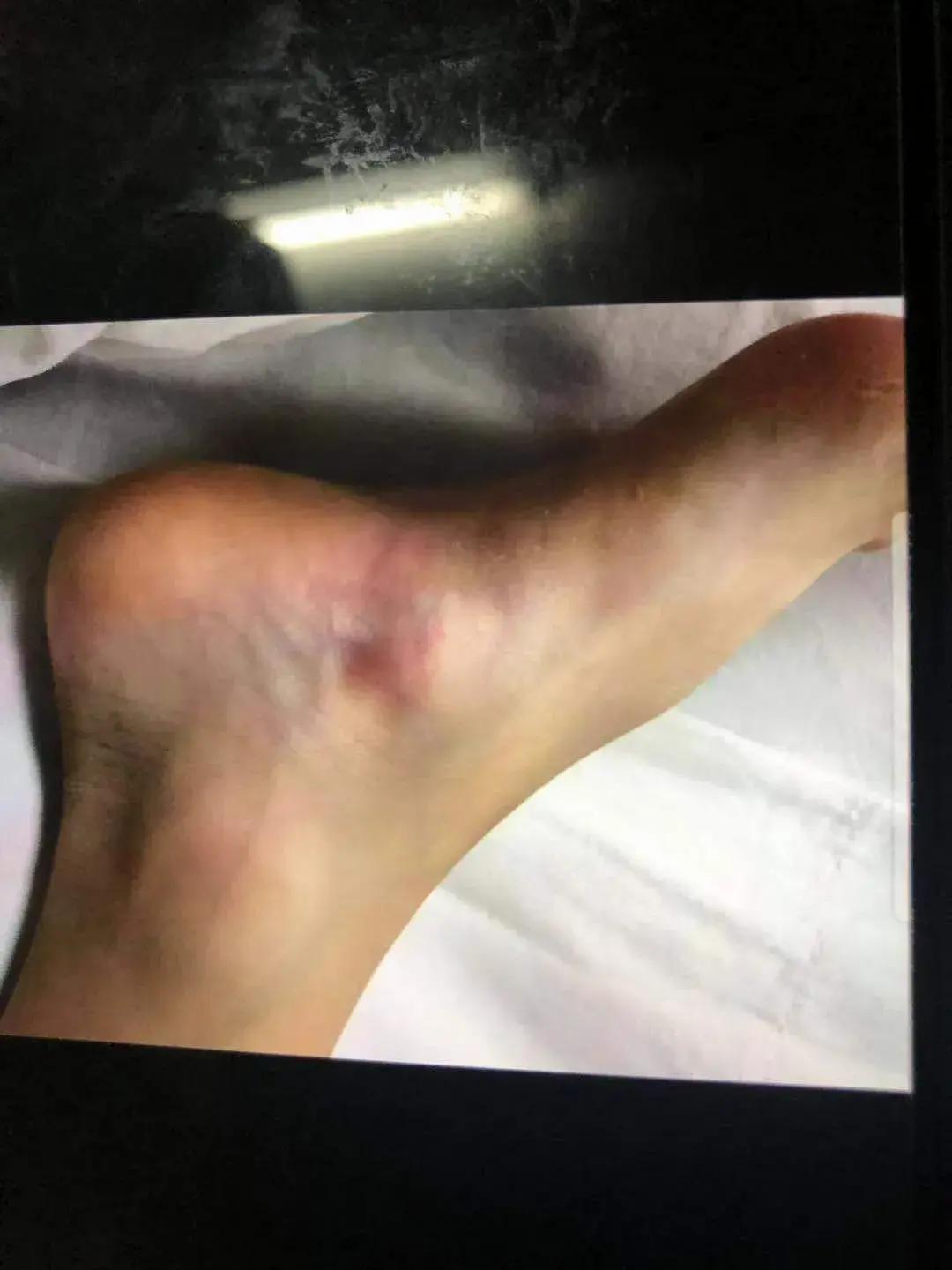 7岁孩子被少林寺和尚打死，只拘留14天罚500元，父亲维权至今无果