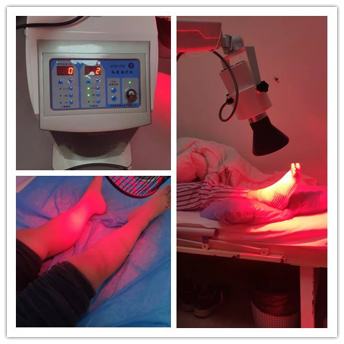 拇外翻手术后脚还在肿是什么原因,脚骨折手术后三个月还肿正常吗