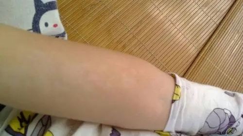 阴毛有什么用？能不能刮掉？由黑变白，意味着什么？