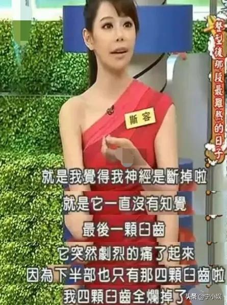 整容达人200次整容失败整成僵尸,整容成功逆袭案例削骨