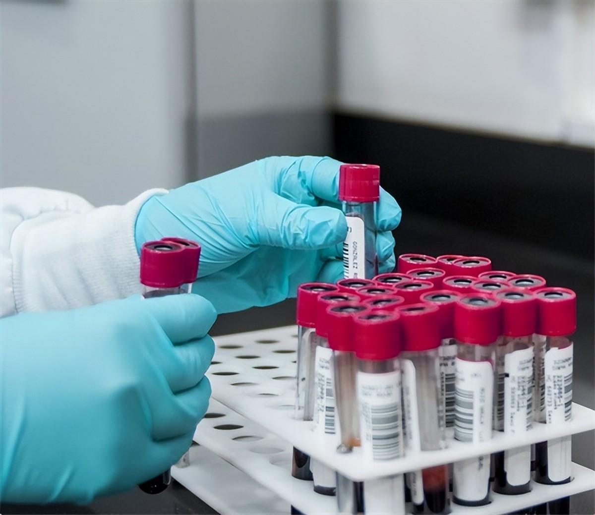 中国蛇毒女王是谁,广西蛇毒王事件