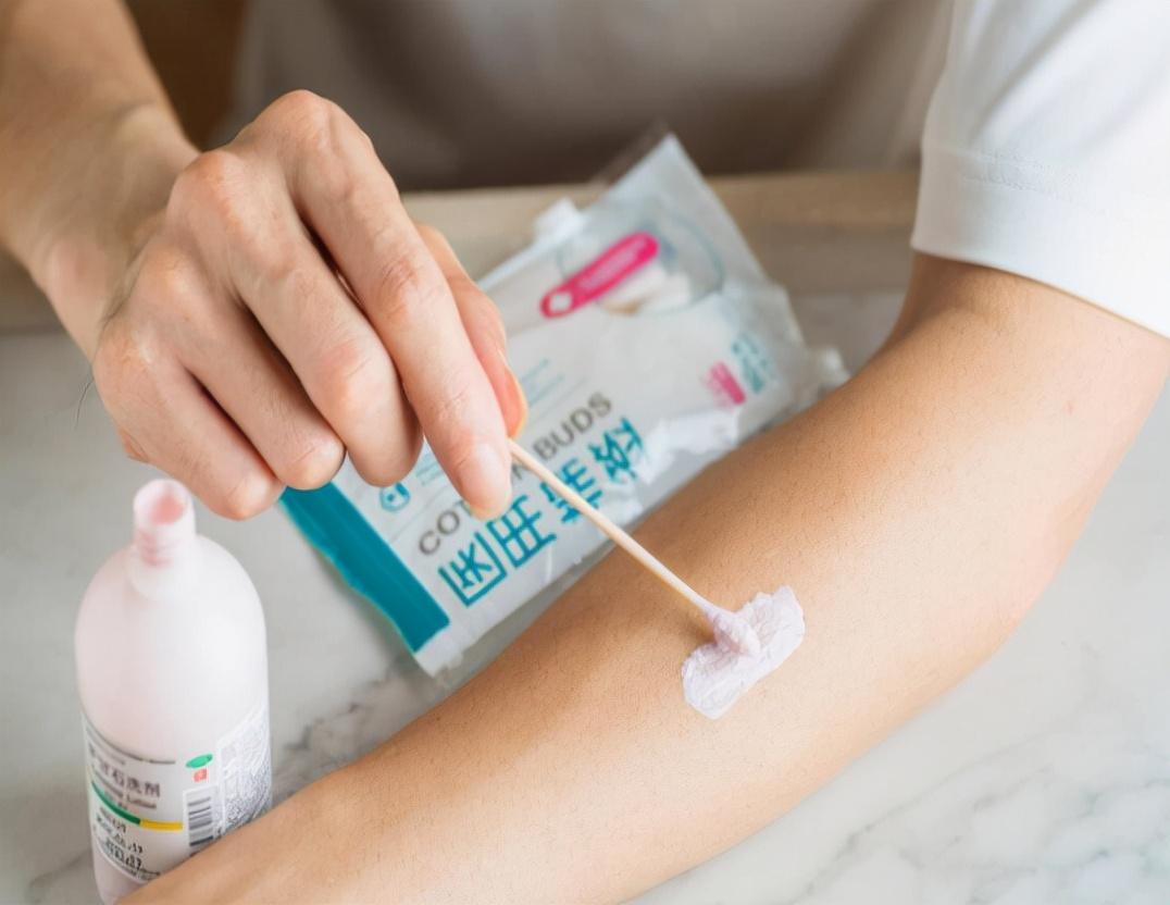 炉甘石洗剂有贵有便宜怎么选,几块钱一瓶的炉甘石洗剂