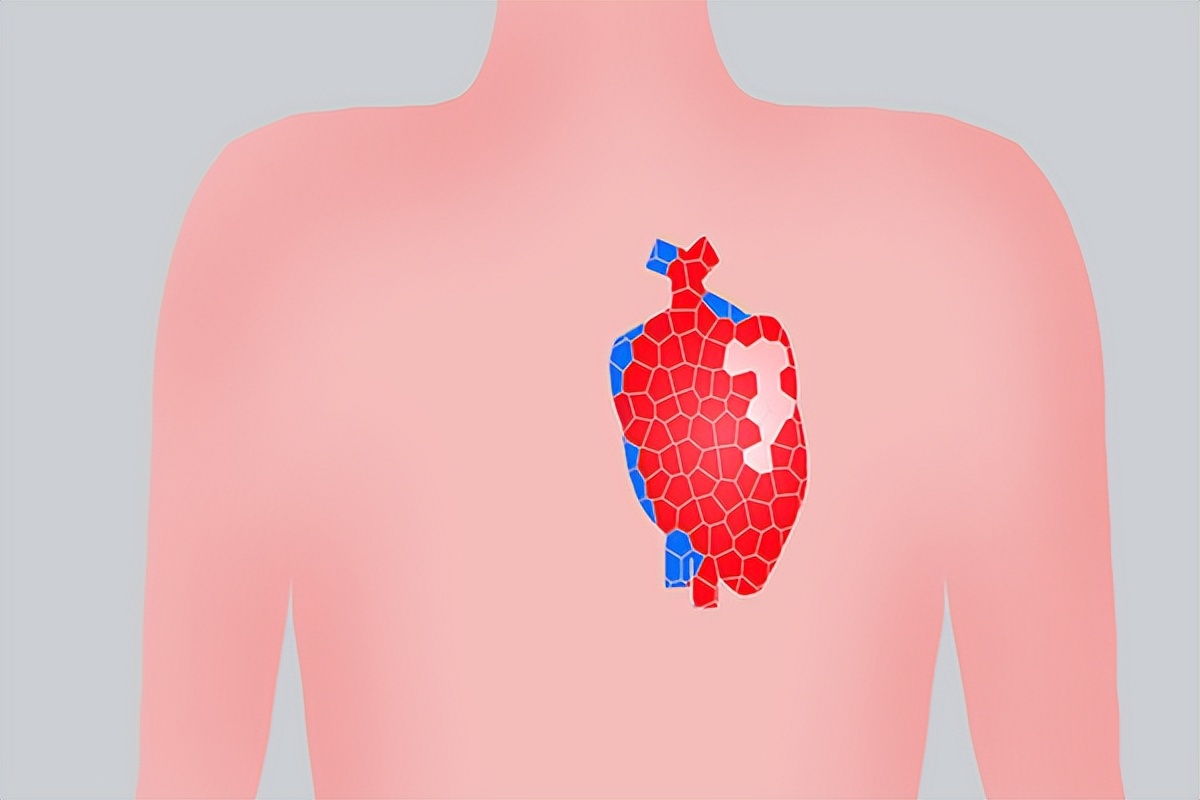 心肌中度缺血怎么补,心肌缺血怎么调理才能好得快