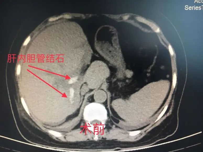 医患故事七面锦旗述说生命奇迹,医院锦旗故事