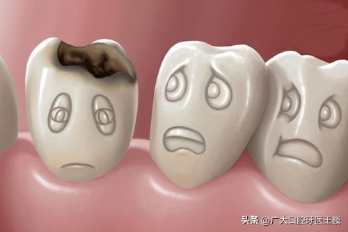 蛀牙烂空了怎么办只剩肉,蛀牙烂空了松动必须得拔掉吗