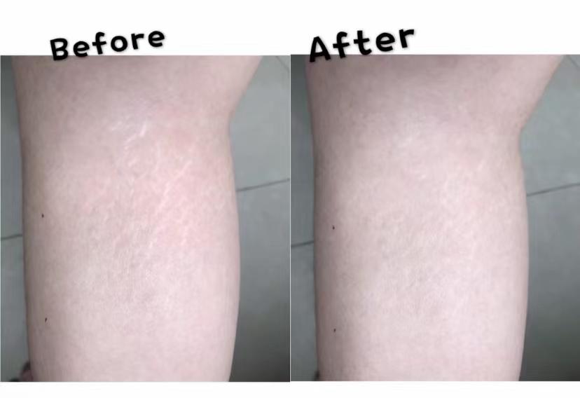 妊娠油有什么坏处,妊娠油有必要用嘛