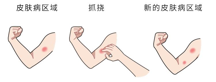 两块钱的红霉素软膏有什么用途,几块钱的红霉素软膏有多神奇