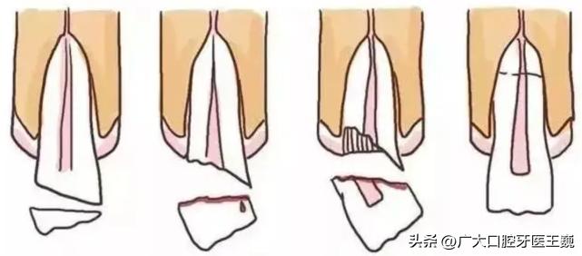 口腔科普出现问题,口腔科普牙齿松动了拔还是不拔