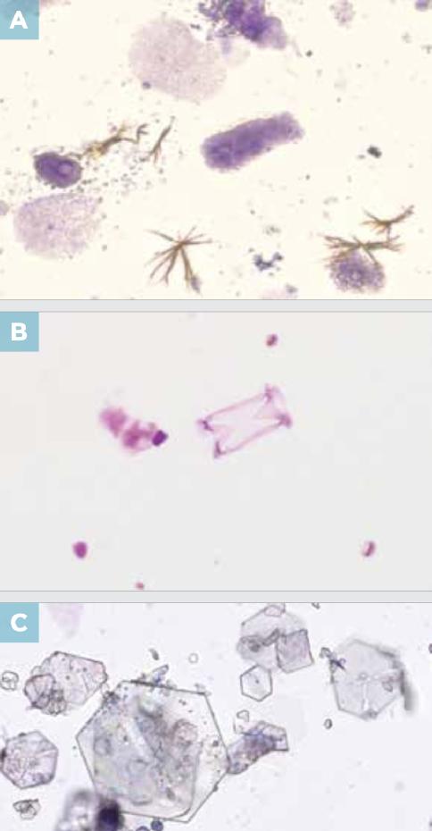 尿液干化学分析的实验原理,尿液标本采集操作