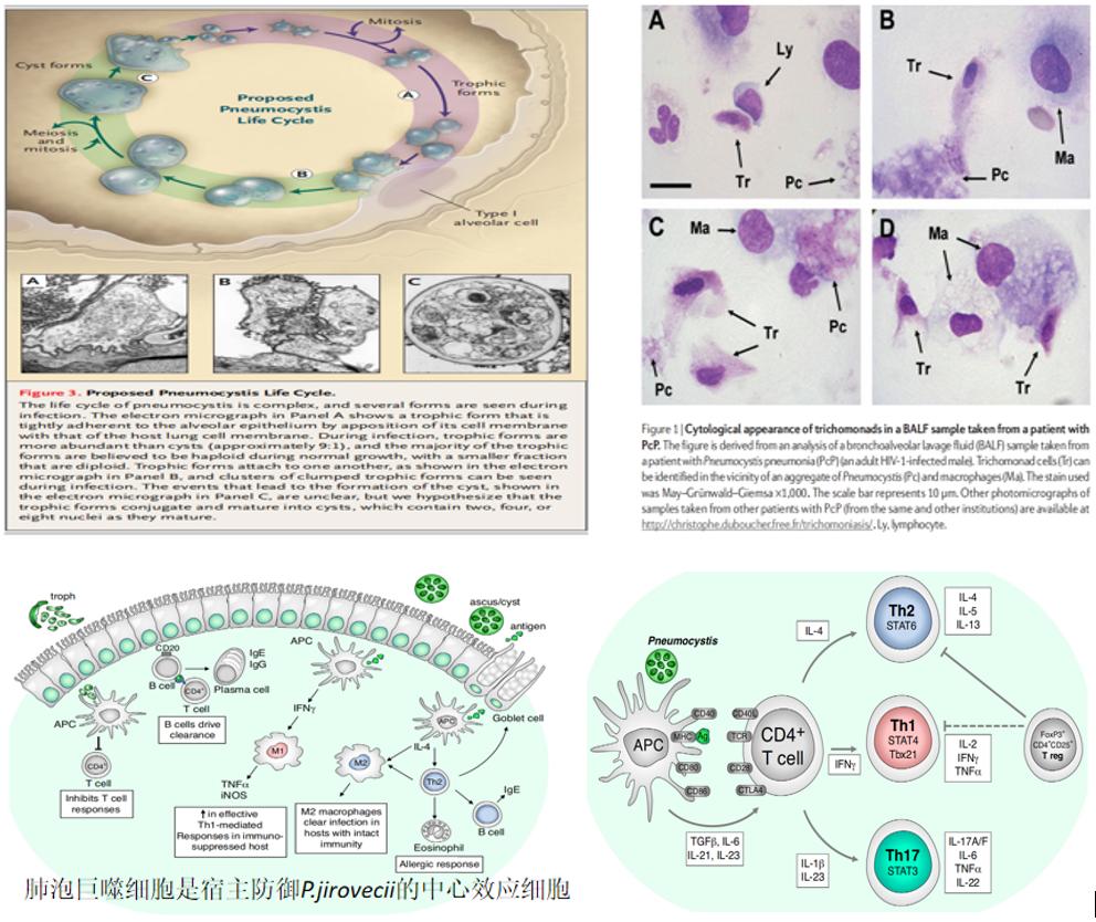 hiv感染肺孢子菌肺炎,hiv患者检查出耶氏肺孢子菌