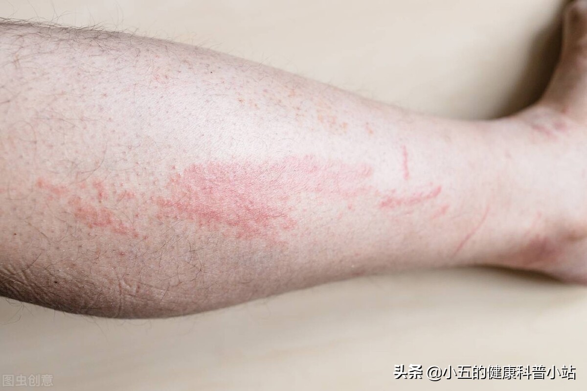 人老腿先衰8个表现预示你已衰老,人老腿先老的三种表现