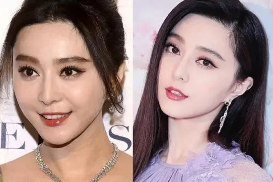 范冰冰做烤瓷牙前后照,范冰冰做的牙贴片还是烤瓷牙