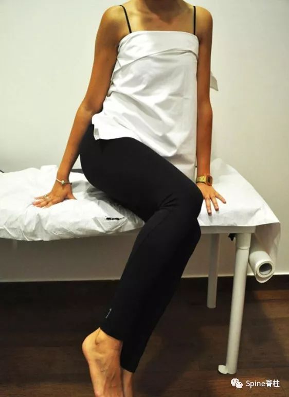 腰椎间盘突出下肢放射痛严重吗,下肢放射疼痛是间断性严重吗