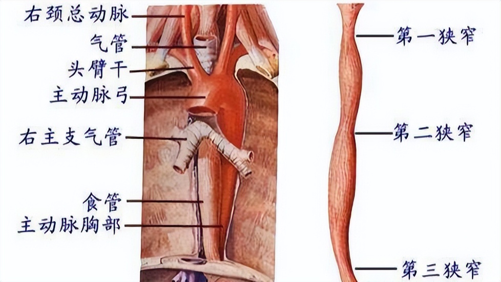 你家卖的鱼有鱼刺吗,吃了鱼让鱼刺卡着了怎么弄